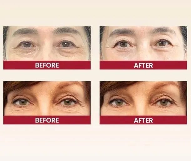 K-SECRET SEOUL 1988 Eye Cream: Retinal Liposome 2% + Fermented Black Bean – Advanced Anti-Aging & Brightening Formula - 30ml