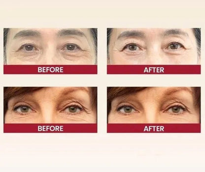 K-SECRET SEOUL 1988 Eye Cream: Retinal Liposome 2% + Fermented Black Bean – Advanced Anti-Aging & Brightening Formula - 30ml