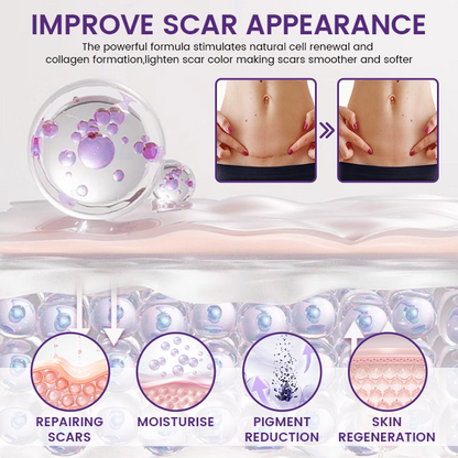 Timilk Regenscar Stem Cell Scar Gel 20g Triple Action Formula For Old And New Scars Surgical Marks Skin Renewal