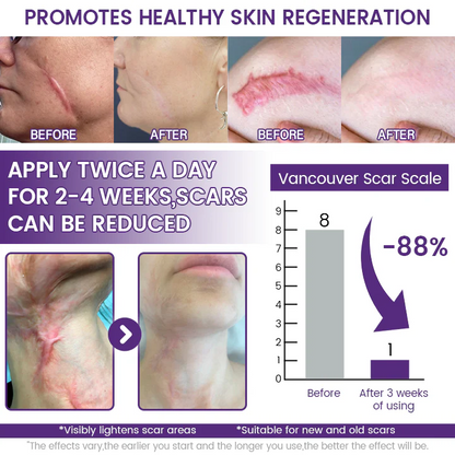 Timilk Regenscar Stem Cell Scar Gel 20g Triple Action Formula For Old And New Scars Surgical Marks Skin Renewal