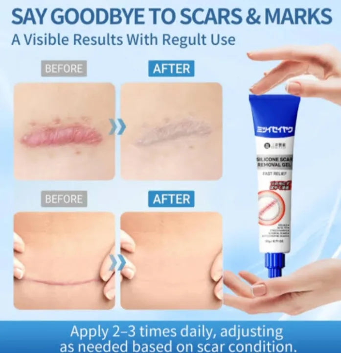 Silicone Scar Removal Gel - Skincare Treatment Designed For Scar Care And Smooth Skin Maintenance Routine - 20g